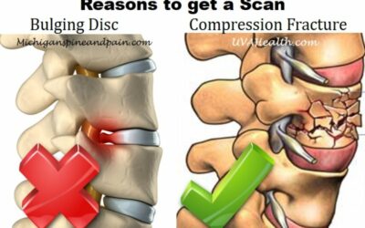 Do You Need A Scan On Your Injured Back?