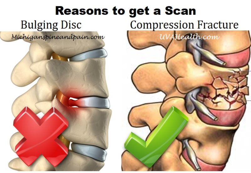 Do You Need A Scan On Your Injured Back?